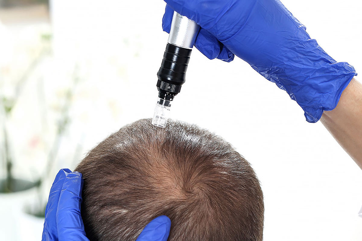 Tratamento Capilar MÍRAME