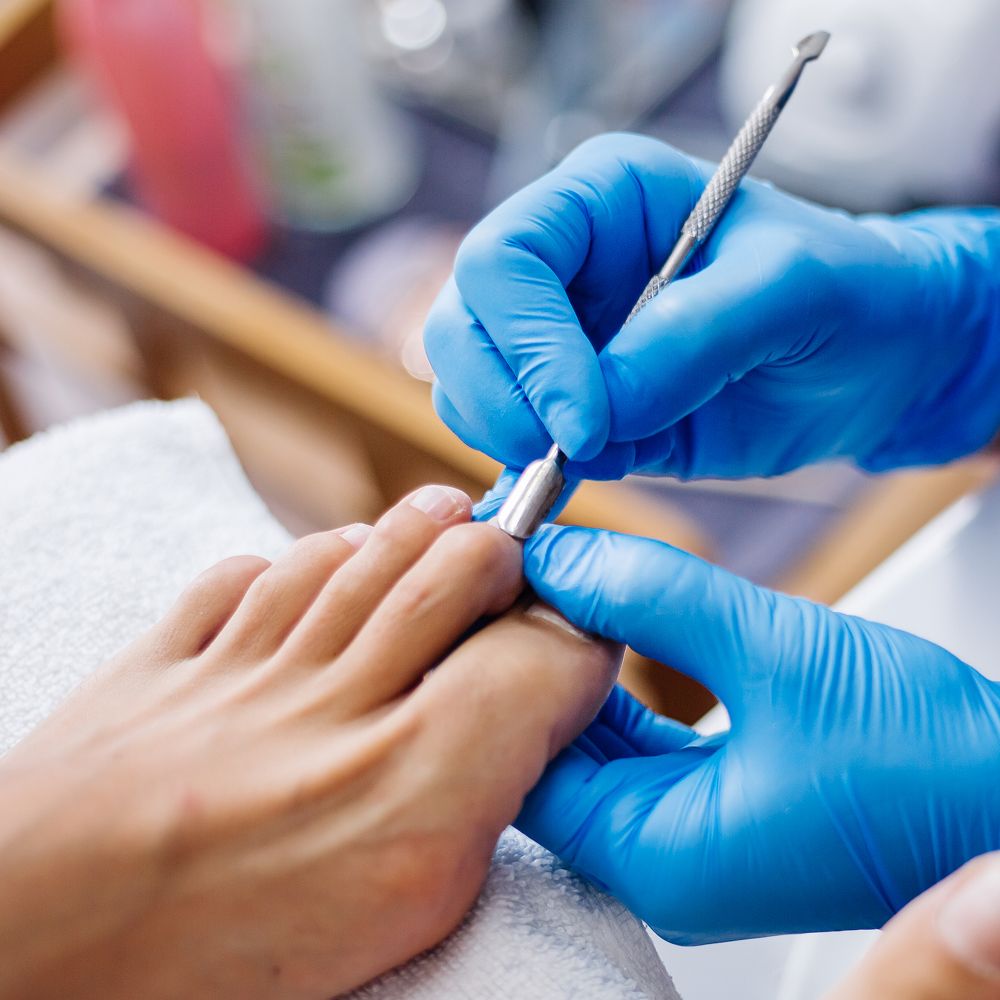 Pedicure Medicinal MÍRAME